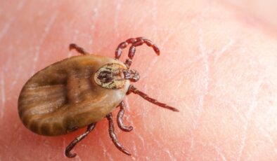 Sivas’ta Kırım Kongo Kanamalı Ateşi Şüphesiyle Bir Can Kaybı Daha